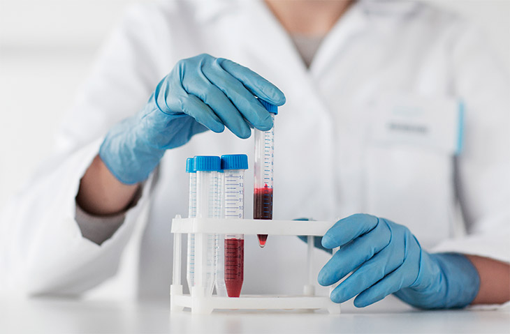 O que é e como é realizada a hematologia laboratorial?