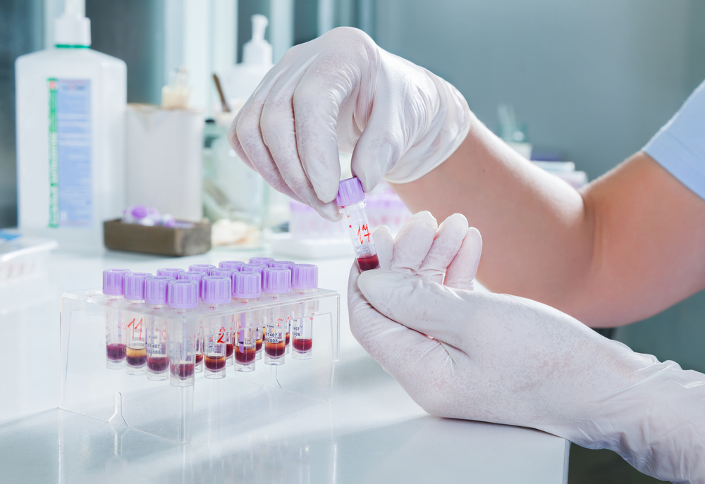 Como conseguir descontos com fornecedores de materiais para laboratório de análises clínicas?