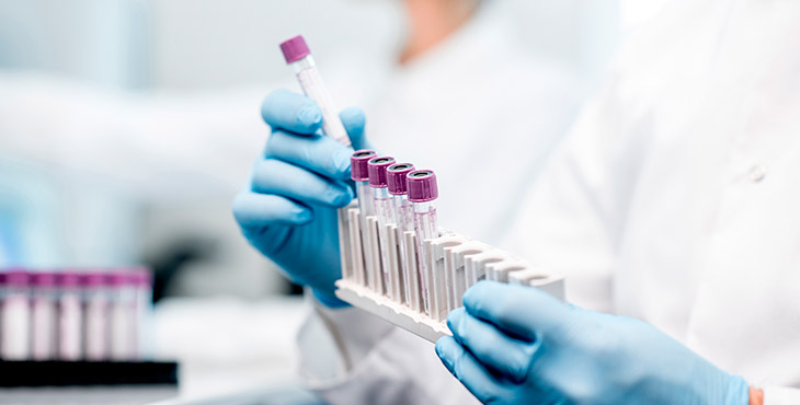 gestao-de-qualidade-laboratorios-de-analises-clinicas-9-erros-mais-comuns