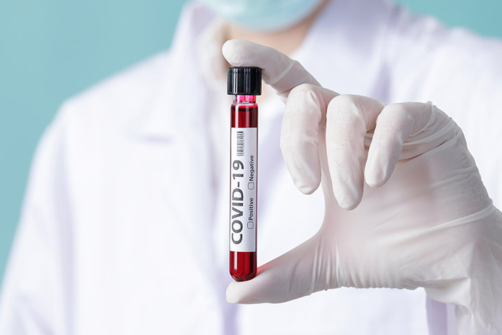 O que os laboratórios de análises clínicas podem aprender com a covid-19?