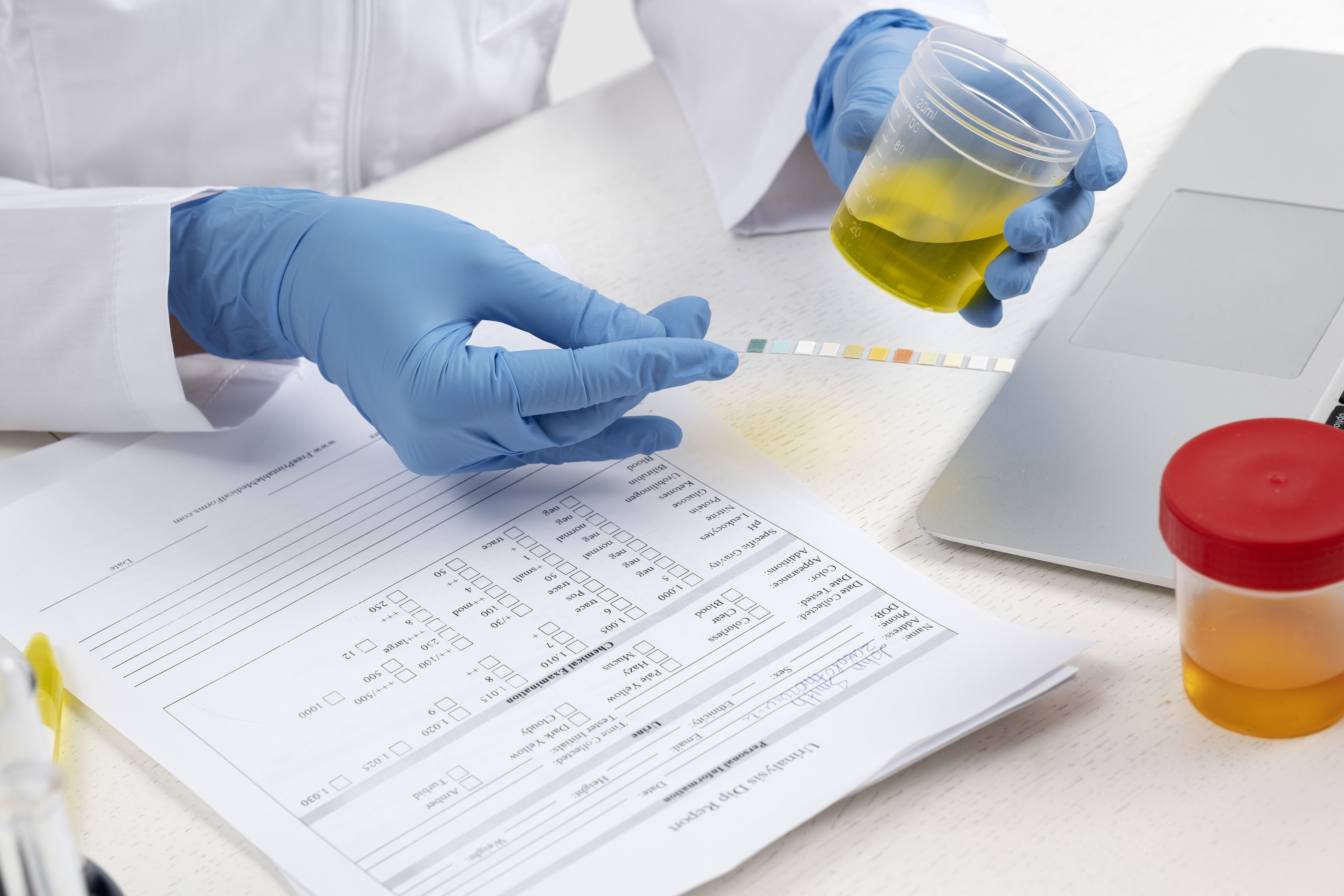 Mercado de Exames Toxicológicos: Oportunidades e desafios
